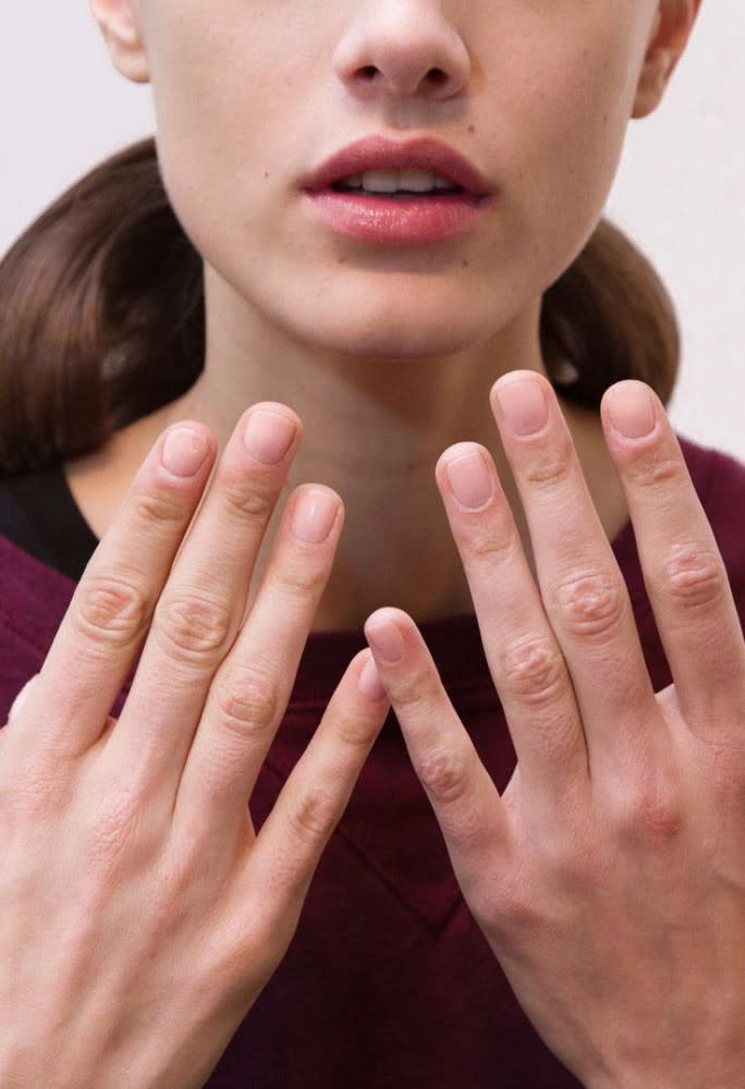 ¿Uñas débiles, quebradizas y manchadas? Es un problema más frecuente de lo que imaginamos y para muchas personas es una enfermedad muy embarazosa que puede causar un verdadero impacto en la calidad de vida del afectado. (Foto: Getty)