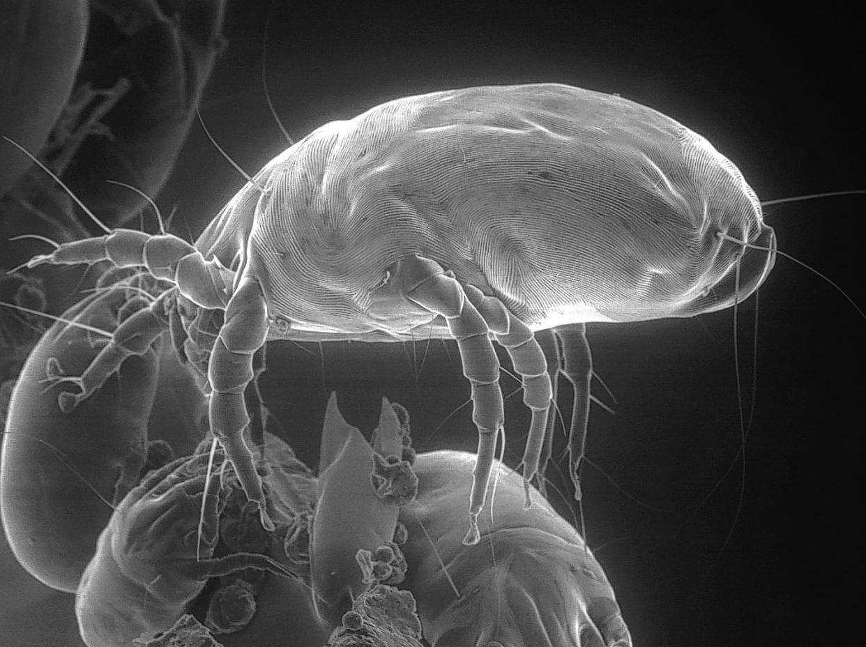 A side view of a house dust mite as seen through an electron microscope. Although the thought of sleeping with millions of dust mites is just plain gross, for most of us it’s not dangerous. For those with allergies, however, the symptoms can be serious.