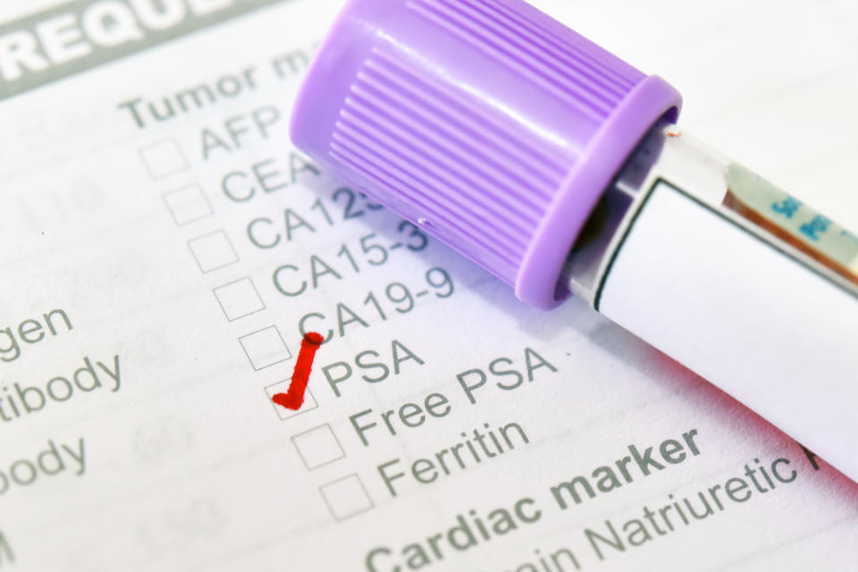 Blood sample tube with lab requisition form for PSA test, prostate cancer diagnosis