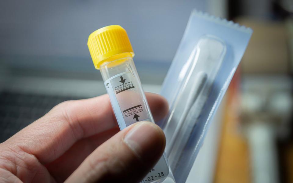 PCR test commonly used to screen patients for gonorrhoea - PCR