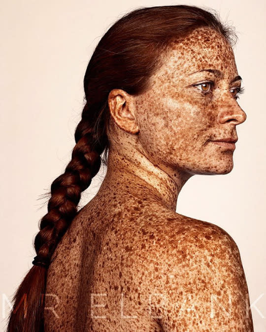 Elbank loved model Leah Sheehan’s full body of freckles.