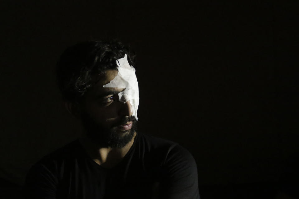 An anti-government protester whose eye was injured during clashes with riot policemen looks towards a light in Beirut, Lebanon, Friday, Oct. 18, 2019. Lebanon erupted in protests Thursday over the government's plans to impose new taxes amid a severe economic crisis, taking their anger on politicians they accuse of widespread corruption and decades of mismanagement. (AP Photo/Hassan Ammar)
