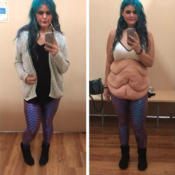 The Instagrammer has shared an honest post about her excess skin. Photo: Instagram