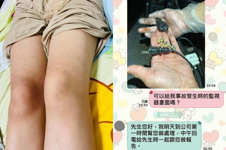 王姓女網友台南吃火鍋遭電擊，左腳癱瘓無知覺。（翻攝自臉書社團「爆料公社」）