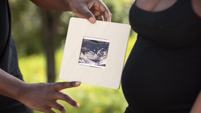 Black parents look at sonogram of their baby.