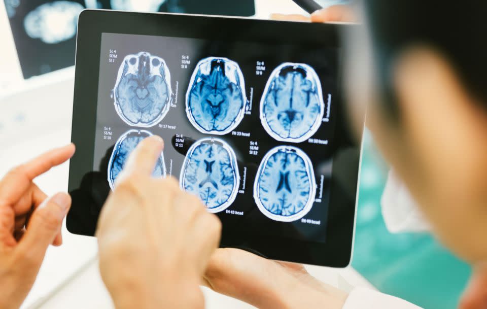 The causes of brain cancer have not been determined as of yet, but Professor Aranda says there’s symptoms that could indicate if someone is affected by it. Source: Getty