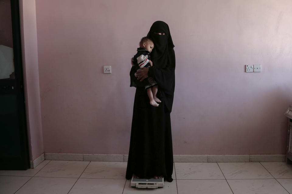 <p>Umm Mizrah, a 25-year-old Yemeni woman, holds her son Mizrah on a scale in Al-Sadaqa Hospital in the southern Yemen city of Aden in this Feb. 13, 2018 photo. Rageh, who is nearly into the second trimester of her pregnancy, weighed 38 kilograms (84 pounds), severely underweight. Mizrah, who was 17 months old, weighed 5.8 kilograms (12.8 pounds), around half the normal weight for his age. (Photo: Nariman El-Mofty/AP) </p>