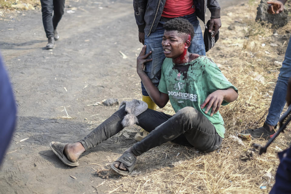 A demonstrator sits after being wounded during a protest against the United Nations peacekeeping force (MONUSCO) deployed in the Democratic Republic of the Congo in Sake, some 15 miles (24 kms) west of Goma, Wednesday July 27, 2022. Officials say more than 15 people have been killed and dozens injured during the demonstrations against the UN mission in the country, heading into their third day. (AP Photo/Moses Sawasawa)