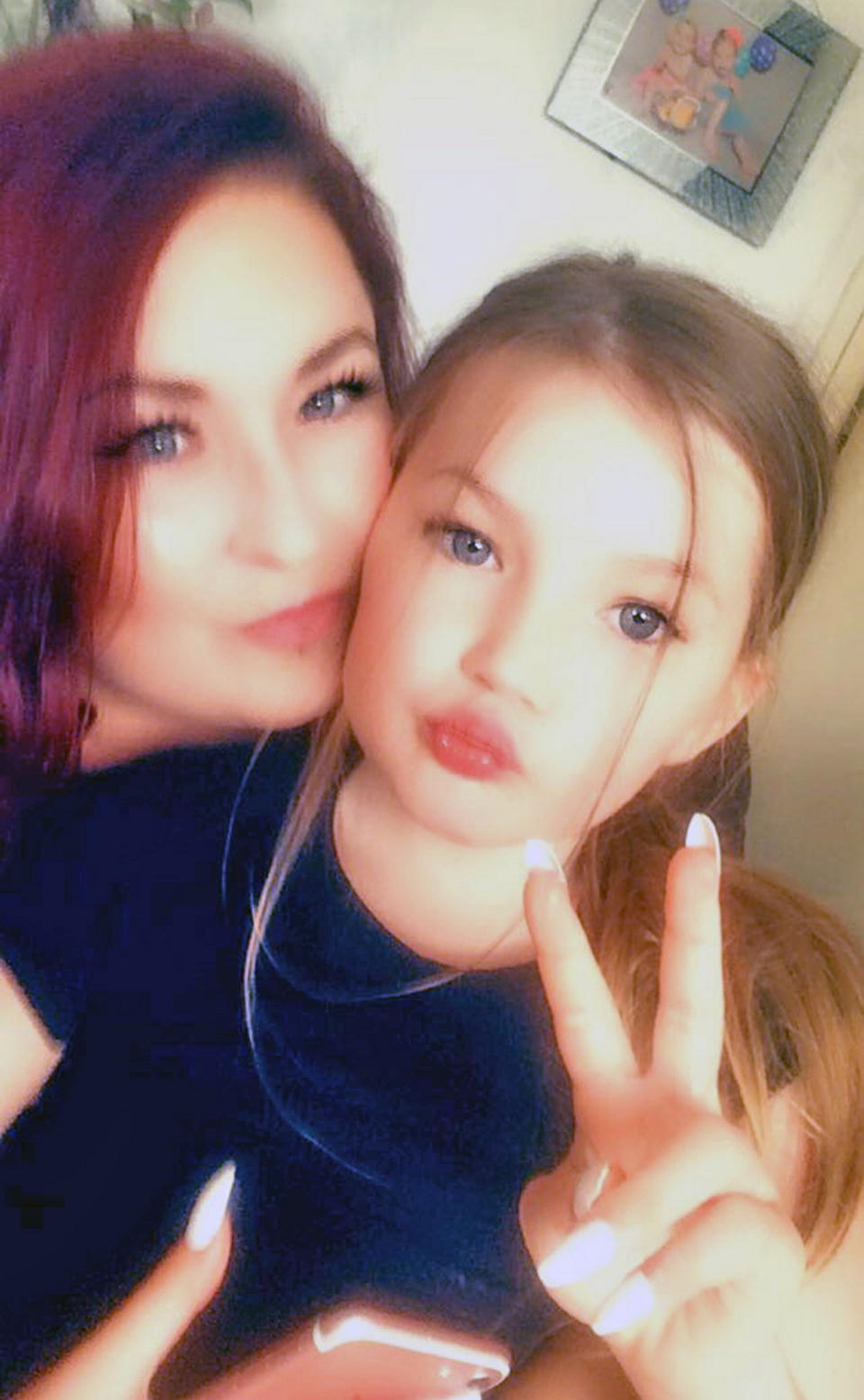 Pictured: Kayleigh McColl with her daughter Elliemai Smith.

An eight year old girl suffered concussion and a broken leg when a hit-and-run e-scooter rider ploughed into her on a footpath at 'over 20mph'.  Elliemai Smith was sent flying as the scooter smashed into her before the man riding it sped off, leaving her crying on the ground.

She was then rushed to hospital in an ambulance.  Police are now hunting the illegal rider and Elliemai's mother, 28 year old Kayleigh McColl, has appealed for anyone who recognises his description to come forward.  SEE OUR COPY FOR DETAILS.

Please byline: Family/Solent News

© Family/Solent News & Photo Agency
UK +44 (0) 2380 458800
 *** Local Caption *** Submitted to us by mum Kayleigh McColl,

07740906872
kayleighlouisepennie@gmail.com
