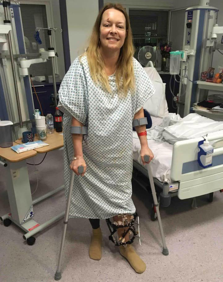 Melissa was shown smiling and recovering from her injuries (SWNS)