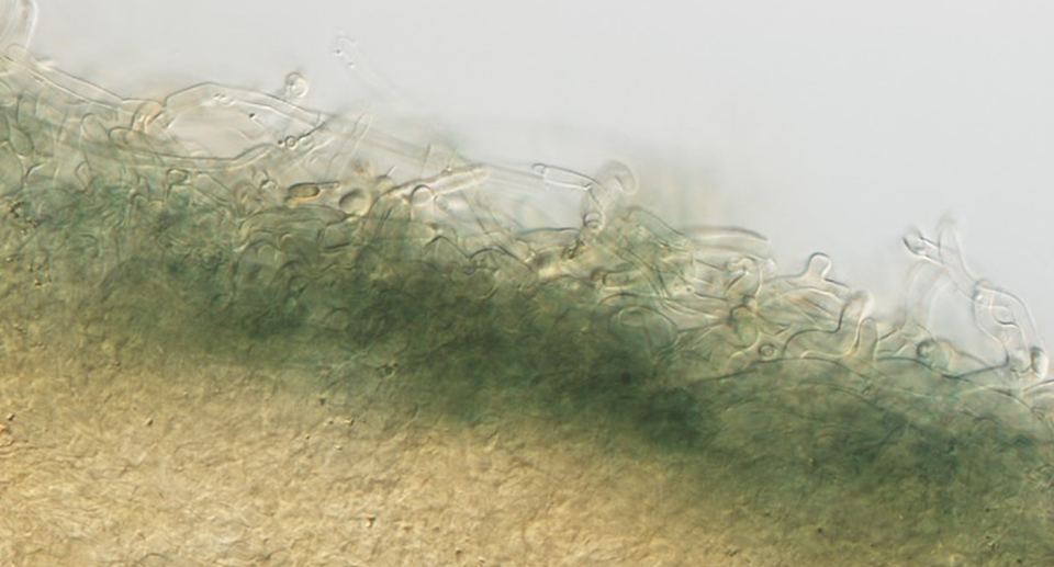 A close-up slide showing Pseudobaeospora taluna.
