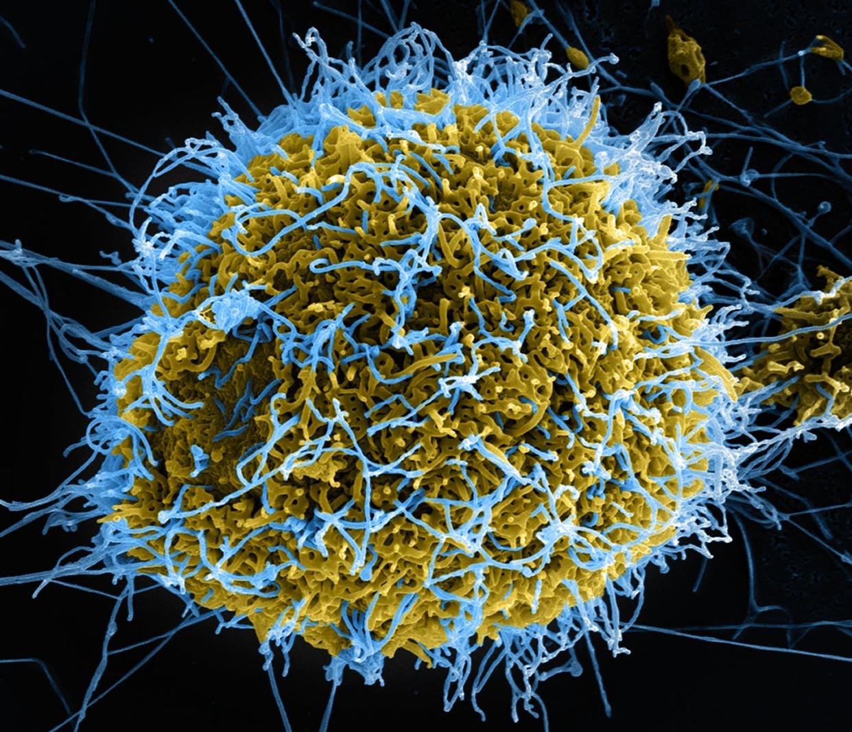 <span class="caption">Colorized scanning electron micrograph of filamentous Ebola virus particles (blue) budding from an infected cell (yellow-green). </span> <span class="attribution"><a class="link " href="https://flic.kr/p/o15Y5n" rel="nofollow noopener" target="_blank" data-ylk="slk:NIAID;elm:context_link;itc:0;sec:content-canvas">NIAID</a>, <a class="link " href="http://creativecommons.org/licenses/by/4.0/" rel="nofollow noopener" target="_blank" data-ylk="slk:CC BY;elm:context_link;itc:0;sec:content-canvas">CC BY</a></span>