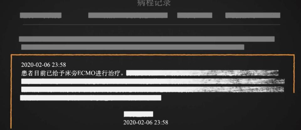 病程記錄指，2020 年 2 月 6 日指，李文亮接受人工肺（ECMO）治療，但醫囑未有提及。