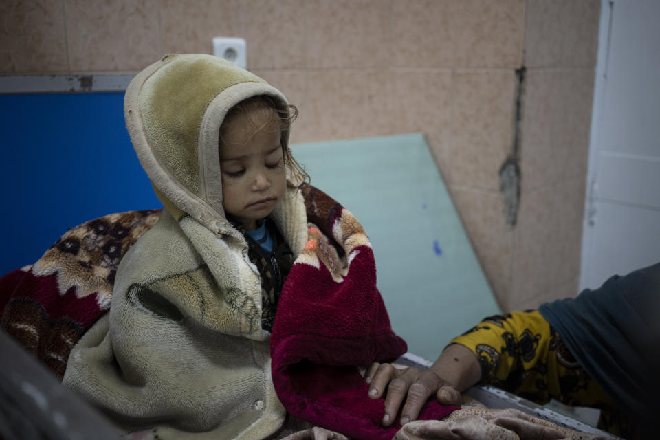 Guldana, 2 years old, who is malnourished, sits on a hospital bed in the Indira Gandhi hospital in Kabul, Afghanistan on Monday, Nov. 8, 2021. The number of people living in Afghanistan in near-famine conditions has risen to 8.7 million according to the World Food Program. (AP Photo/Bram Janssen)