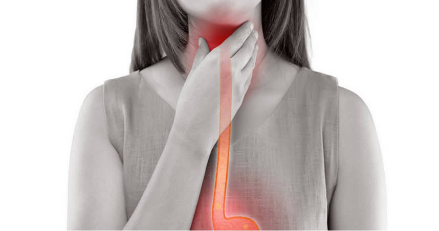 婦人喉嚨痛長達半年，尋醫後發現喉嚨竟然長了「骨刺」。（示意圖／取自Pixabay）