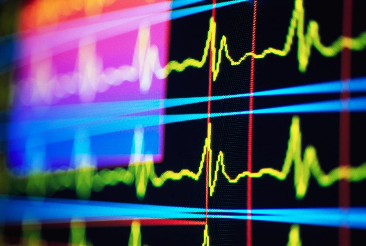 Electrocardiograms, or ECGs, record the electrical activity of your heart. <a href="https://www.gettyimages.com/detail/photo/heart-rate-monitor-royalty-free-image/523791776" rel="nofollow noopener" target="_blank" data-ylk="slk:Randy Faris/The Image Bank via Getty Images;elm:context_link;itc:0;sec:content-canvas" class="link ">Randy Faris/The Image Bank via Getty Images</a>