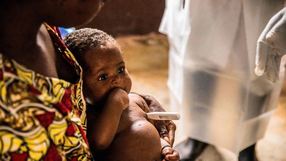 Un bebé y su madre infectados aguardan a ser atendidos por viruela del mono en la República Centroafricana.