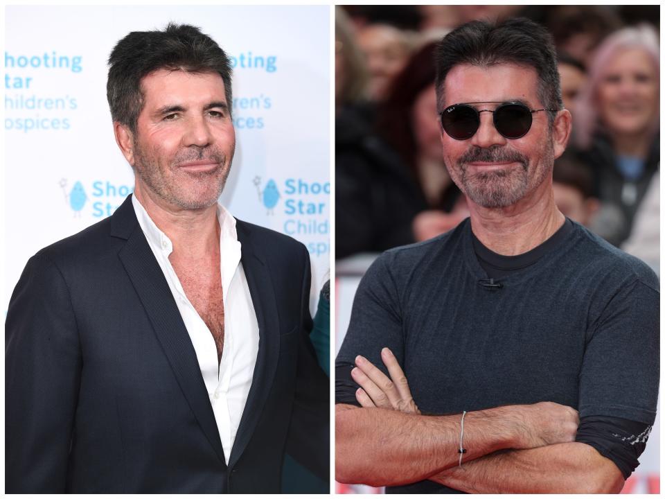 Simon Cowell said his 8-year-old son was part of the reason he got his facial filler dissolved.