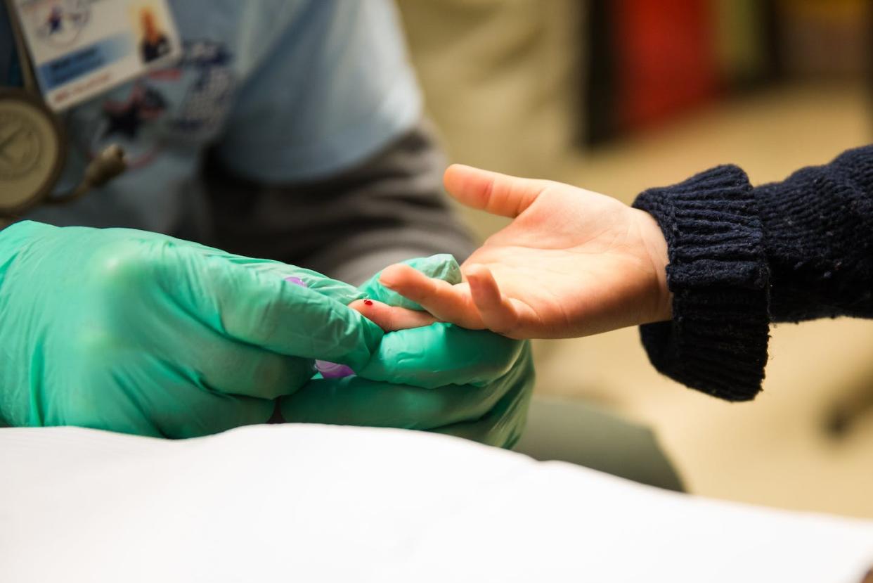 Testing kids for lead exposure starts with a fingertip prick. <a href="https://www.gettyimages.com/detail/news-photo/brian-jones-a-first-responder-for-livingston-county-news-photo/506974822" rel="nofollow noopener" target="_blank" data-ylk="slk:Brett Carlsen/Getty Images;elm:context_link;itc:0;sec:content-canvas" class="link ">Brett Carlsen/Getty Images</a>