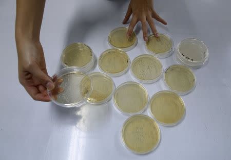 A researcher shows petri dishes containing Lactobacillus colonies forming at Otemchi Biotechnology's laboratory in Singapore April 24, 2015. REUTERS/Edgar Su