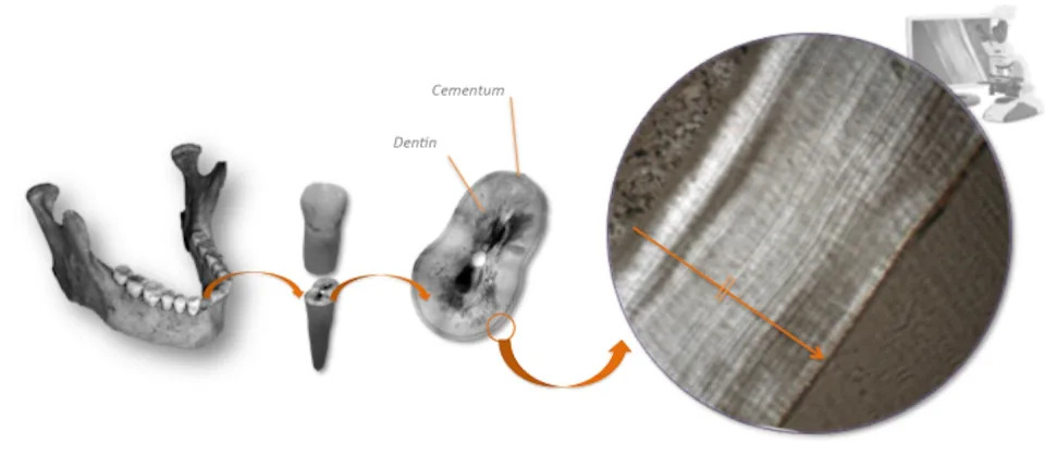 jawbone with teeth, a tooth, and a microscopy view of layers within a tooth's cementum