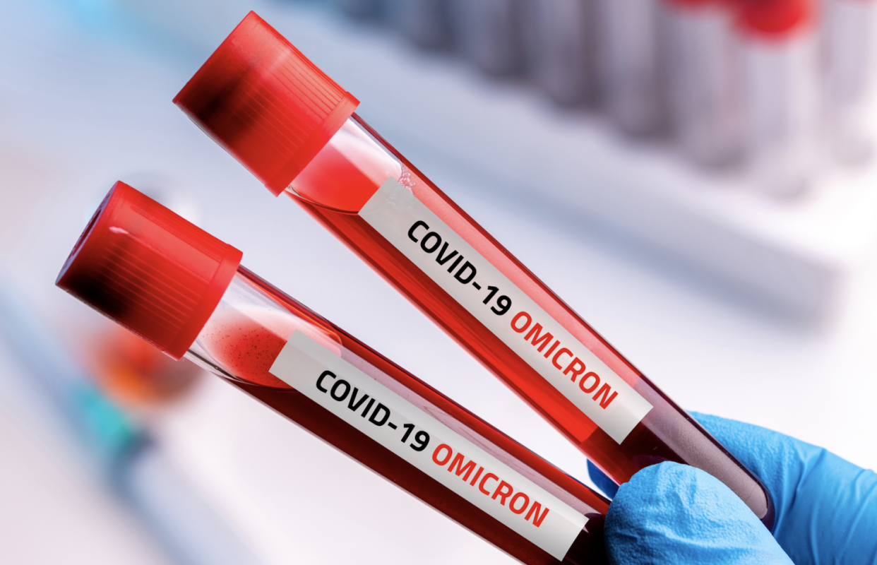 Doctor with blood sample of Covid-19 Omicron B.1.1.529 Variant. (FILE PHOTO: Getty Images)