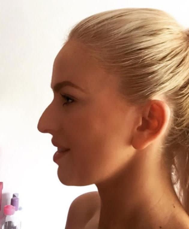 The plastic surgery PR likens her nose to a toucan's beak. Photo: Instagram