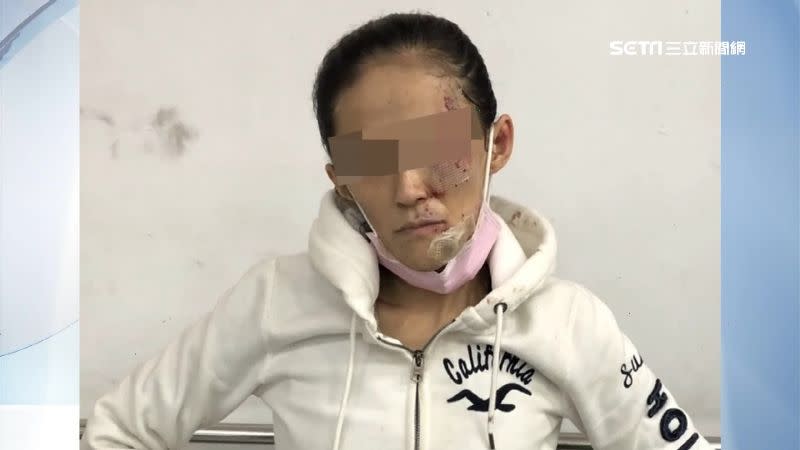 女子被捕到案時仍滿臉是傷。