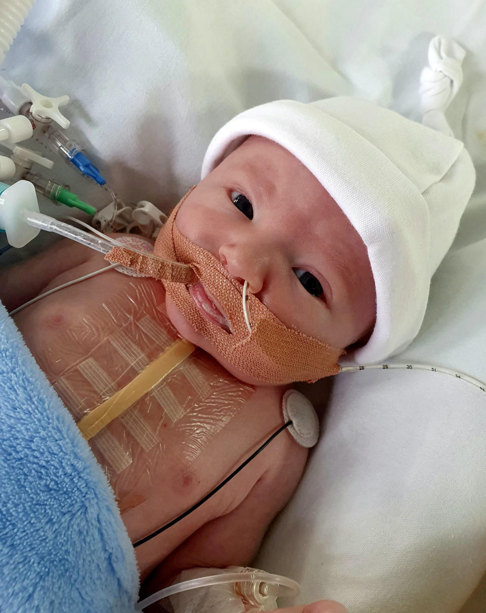 Little Rory underwent open heart surgery at just 18 hours old. (SWNS)