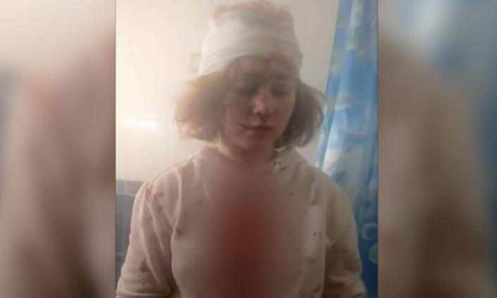 <div class="inline-image__caption"><p>Teacher Ksenia Kuzyura's daughter, Tatiana, was wounded when a bombing hit her school. <em>This photo has been edited to blur out blood.</em></p></div> <div class="inline-image__credit">Anna Nemtsova/The Daily Beast</div>