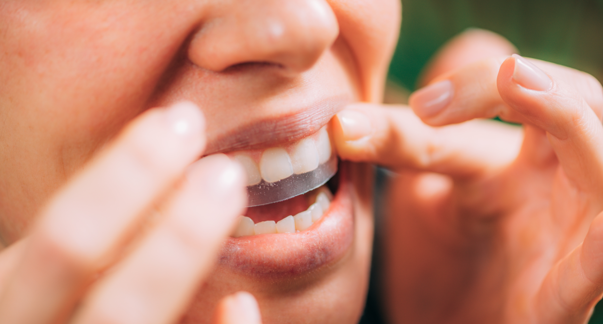 close up of woman putting on whitestrips on teeth, teeth whitening strips on smile, Crest 3D White Whitestrips Professional Effects Teeth Whitening Kit, 22 Treatments, 13 Levels Whiter