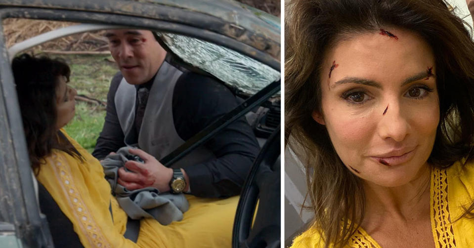 L: Home and Away stars Ada Nicodemou and James Stewart in a car crash. R: Ada Nicodemou takes a selfie with cuts on her face
