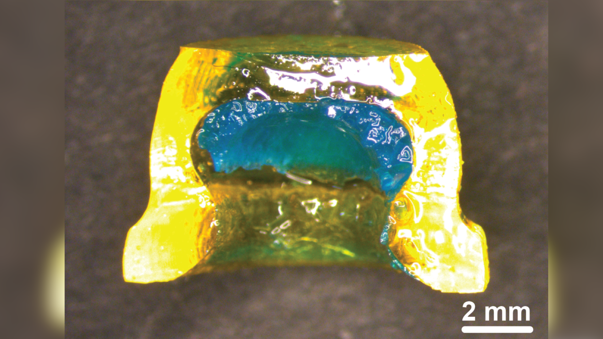  A small, yellow sucker-shaped device filled with a blue gel. 