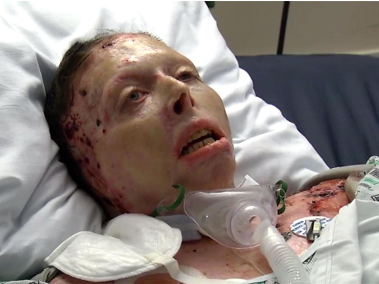 Judy Malinowski was set on fire by her former partner: ABC6/Screengrab