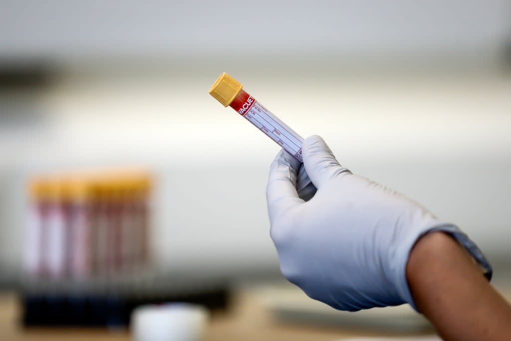 A paramedic holds a test tube containing a blood sample (PA) (PA Archive)