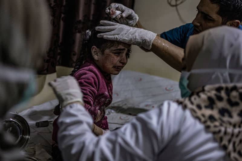 The child Hamsa Shaban seven years old, receives treatment after getting injured as a result of a missile strike targeted the city of Idlib by the Syrian regime. Anas Alkharboutli/dpa