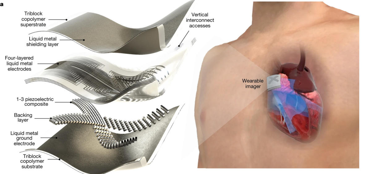 Wearable ultrasound patch could offer real-time heart scans on the go - engadget.com