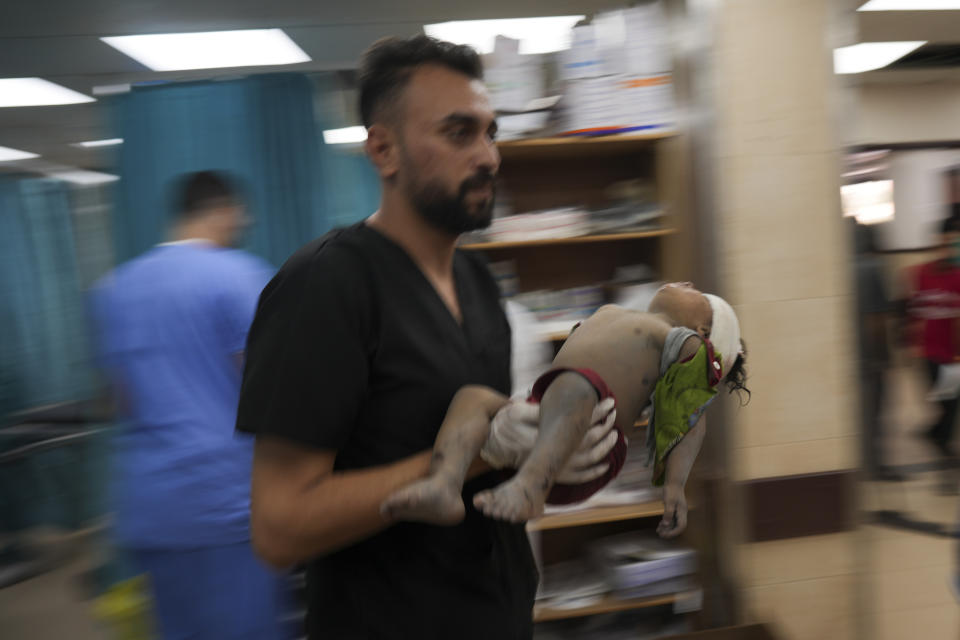 Palestinian child wounded in Israeli bombardment is brought to a hospital in Deir al Balah, south of the Gaza Strip, Thursday, Nov. 2, 2023. (AP Photo/Hatem Moussa)