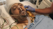 Muhammed Abu Marzouk is seen here receiving treatment after his alleged violent encounter in Mississauga, Ont. Photo from Launchgood.