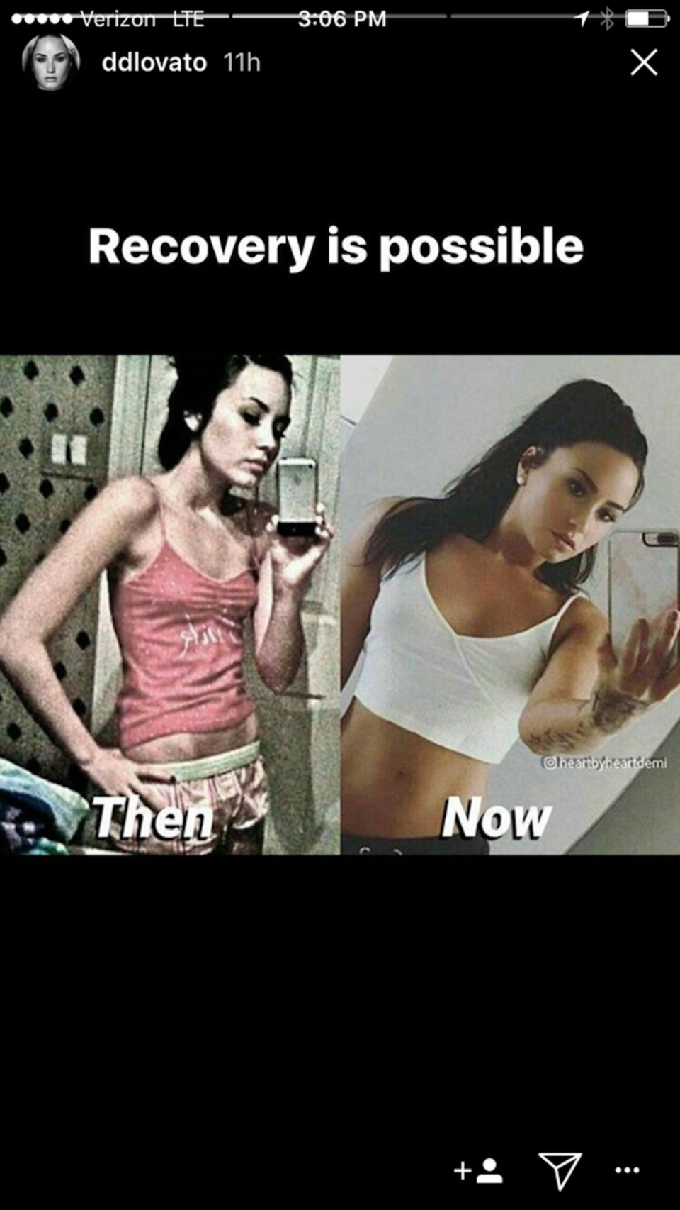 demi-lovato-recovery-is-possible