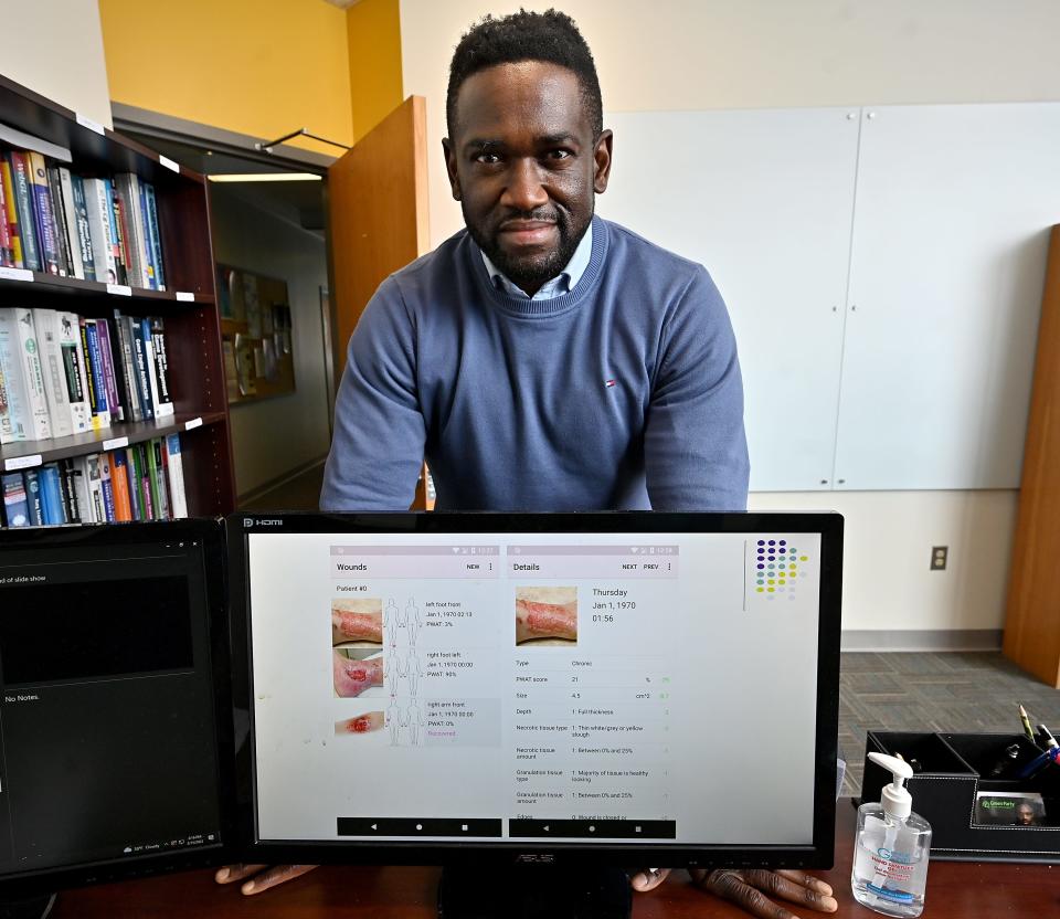 A team led by Worcester Polytechnic Institute researcher Emmanuel Agu and UMass Chan Medical School has been awarded $2.4 million by the National Institutes of Health to develop a smartphone app that will use photographs, heat images, and algorithms to detect infections in the open wounds of patients at home. ​