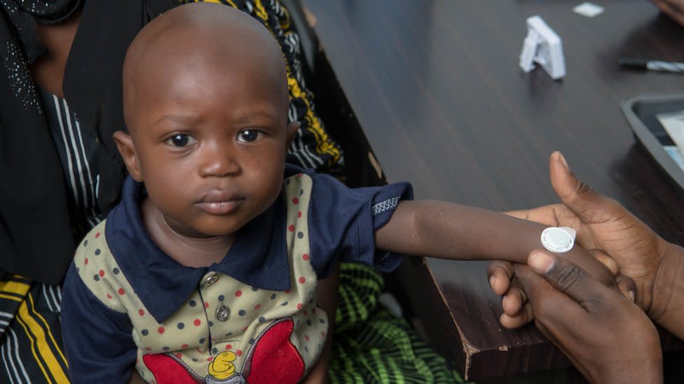 A young Gambian child with a microarray patch applied to the wrist