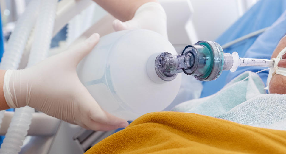 Doctor holding oxygen ambu bag over patient given oxygen to patient by intubation tube in ICU/Emergency room. Source: Getty Images