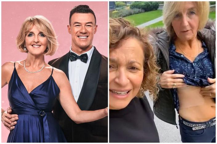 Kaye Adams showed off her rib injury alongside Nadia Sawahla ahead of Strictly second show  (ES Composite)