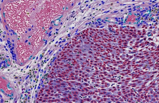 Example of a processed histology slide -- if you look closely, you can see individual features and cells outlined.
