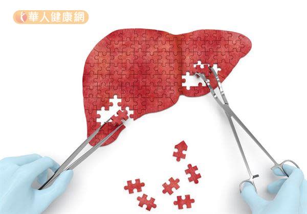 根據衛福部國民健康署資料顯示，103年台灣十大癌症的發生率，肝癌占第4位，死亡率則占第2位，十分驚人。