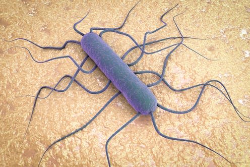 <span class="caption">Endangered species. </span> <span class="attribution"><a class="link " href="https://www.shutterstock.com/image-photo/colonies-listeria-spp-on-palcam-medium-1167180787?src=Am68KMh16GMR5hc9tqAmcQ-1-18&studio=1" rel="nofollow noopener" target="_blank" data-ylk="slk:Kateryna Kon;elm:context_link;itc:0;sec:content-canvas">Kateryna Kon</a></span>