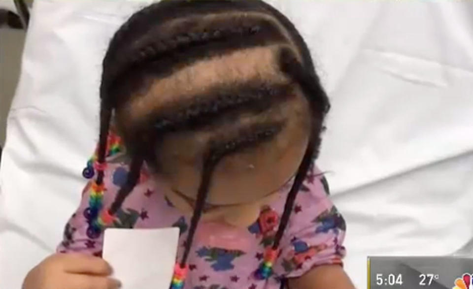 The parents of a three-year-old girl want answers after she was picked up from daycare missing a chunk of her hair. Photo: NBC News