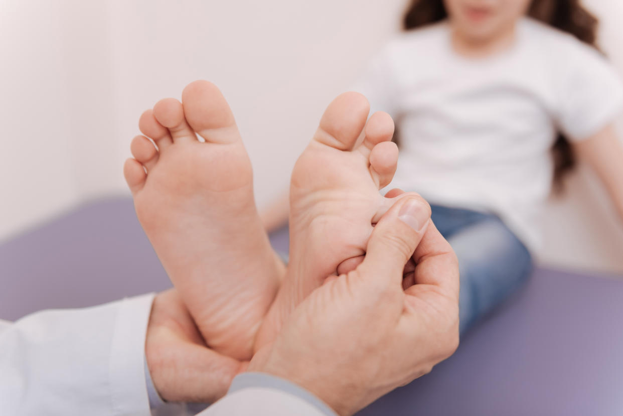 Dermatologists nationwide are seeing a sudden influx of what some are calling "COVID toes." Here's how the condition may be linked to the infection. (Photo: Getty Images) 