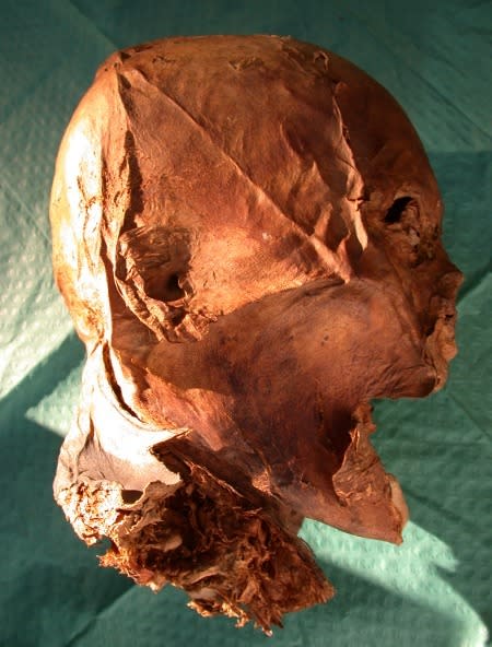 French King Henry IV's embalmed head